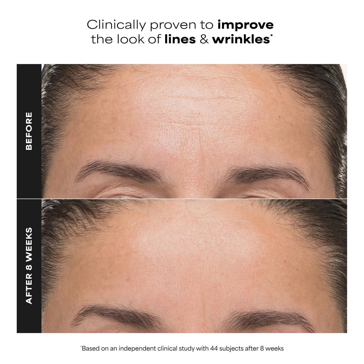 Paula's Choice exfoliant bottle side view