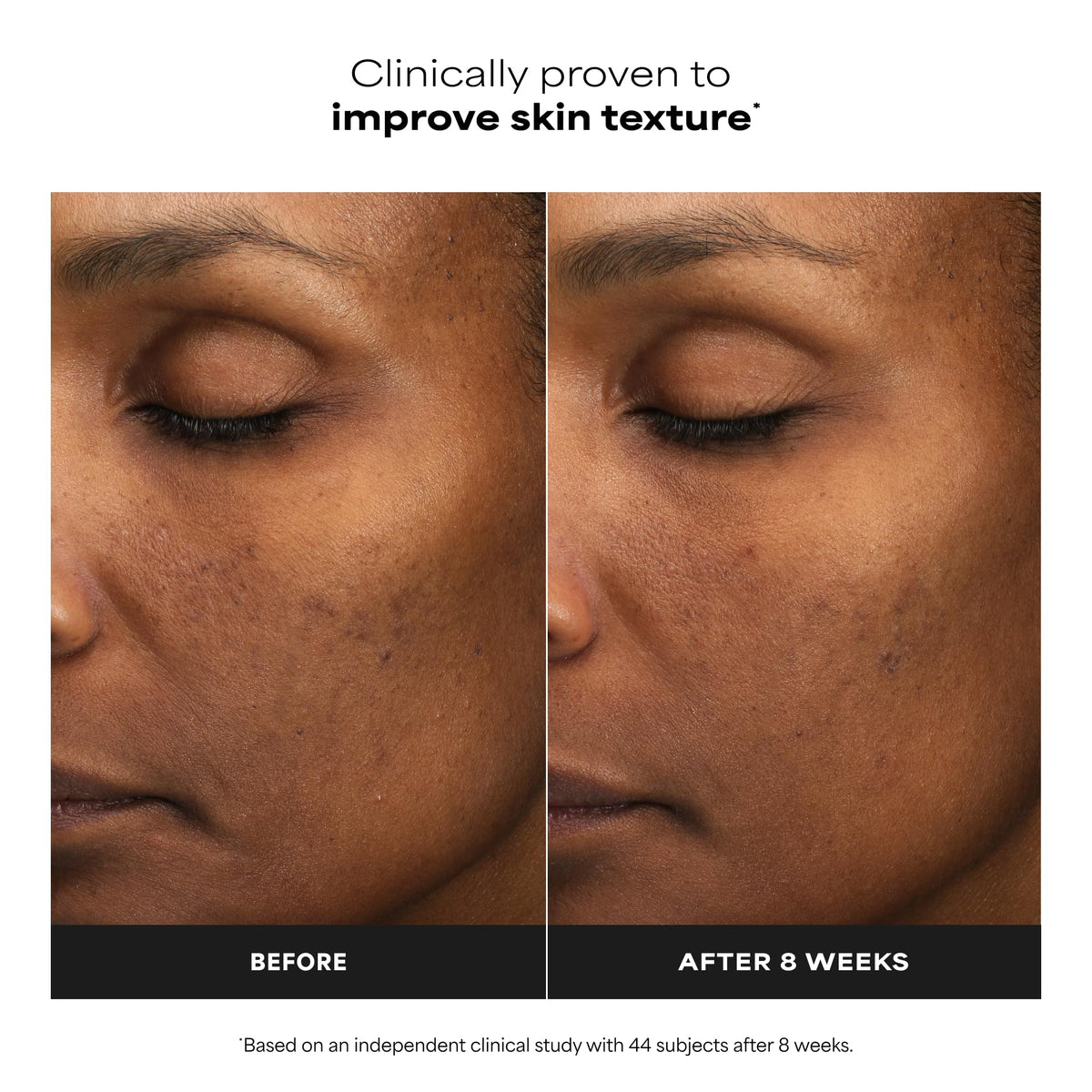 Paula's Choice exfoliant with ingredients list on packaging