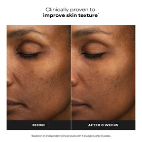 Paula's Choice exfoliant with ingredients list on packaging