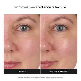 Paula's Choice Niacinamide Face Toner 1 Fl Oz with chamomile extract