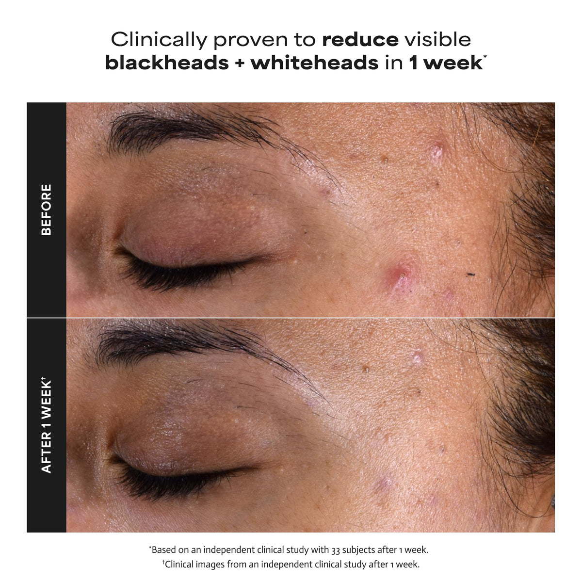 Paula's Choice Skin Perfecting 2% BHA Liquid Exfoliant 1oz packaging details