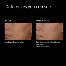 PCA SKIN Intensive Brightening application on skin
