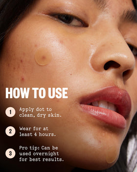 PEACE OUT Acne Healing Dots ingredients list