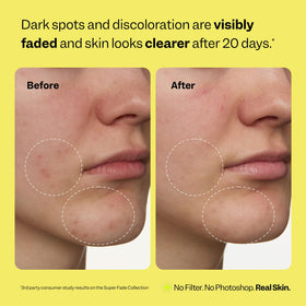 Peach Slices Super Fade Discoloration Serum application on skin