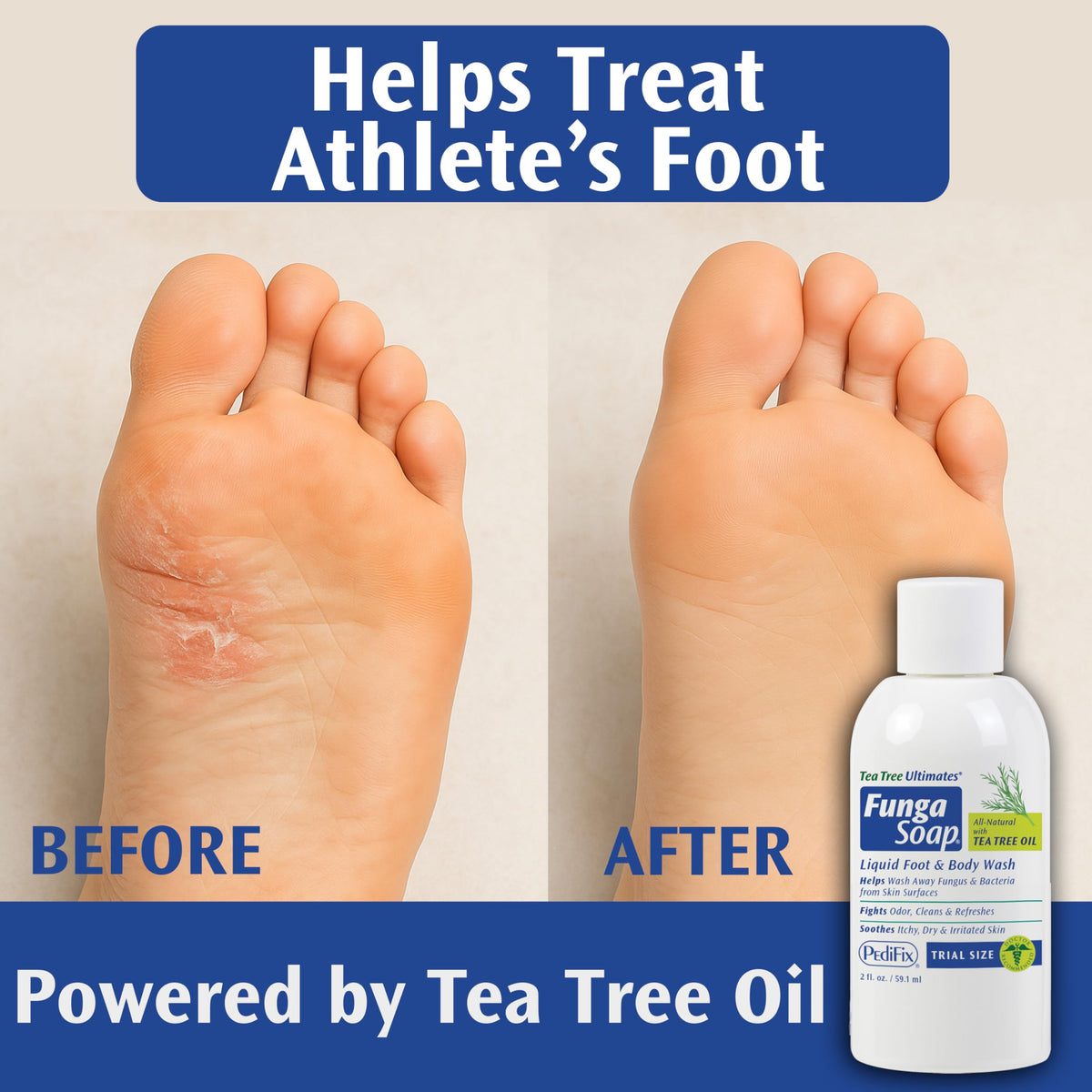 Pedifix FungaSoap Tea Tree Oil Body Wash 2 oz with essential oils