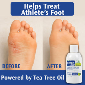 Pedifix FungaSoap Tea Tree Oil Body Wash 2 oz with essential oils