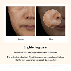 Peeling off Abib Dark Spot Mask to reveal brighter skin