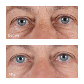 Perricone MD serum application on face