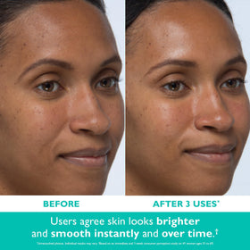 Peter Thomas Roth Even Smoother Instant Reveal Facial Peel swab close-up