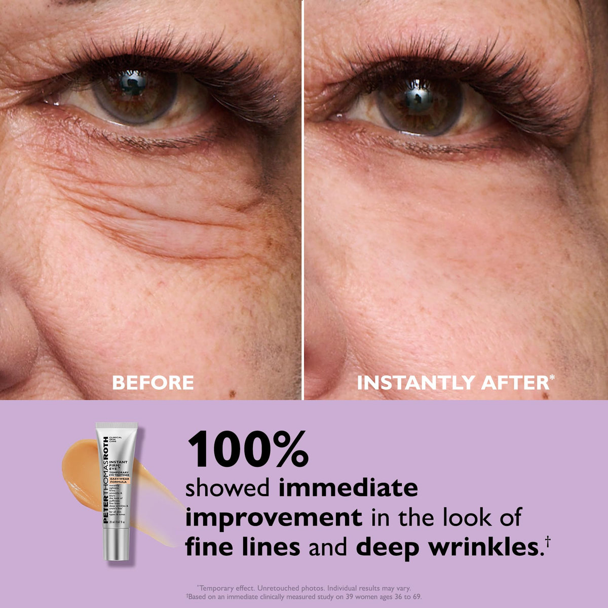 Peter Thomas Roth Instant FIRMx Eye Tightener application on skin
