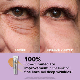 Peter Thomas Roth Instant FIRMx Eye Tightener application on skin