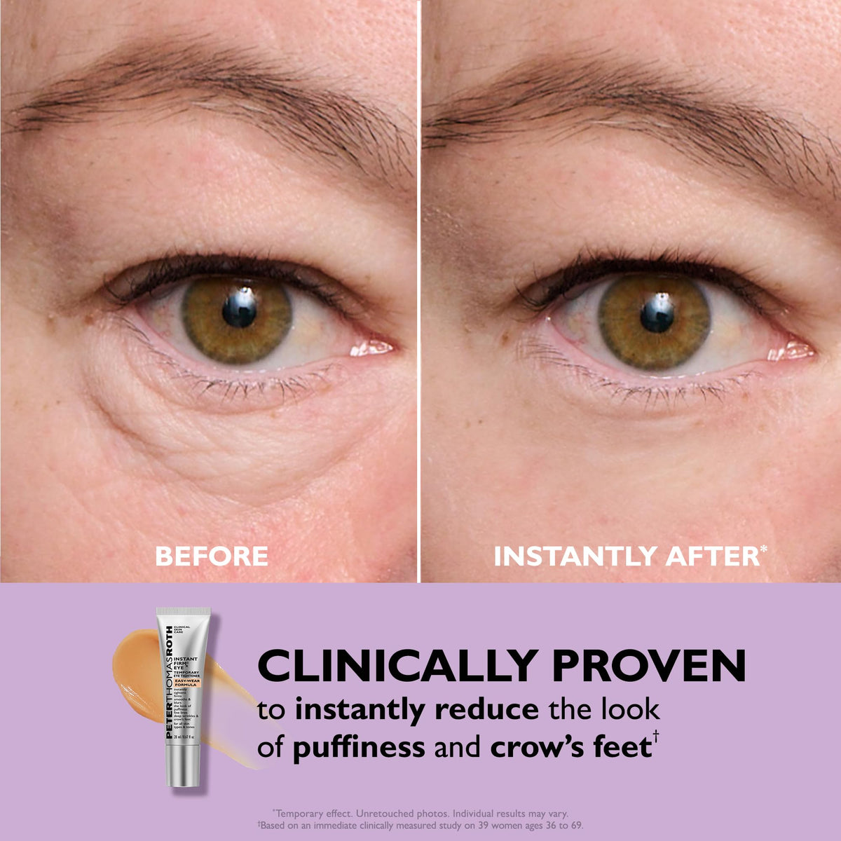 Peter Thomas Roth Instant FIRMx Eye Tightener packaging