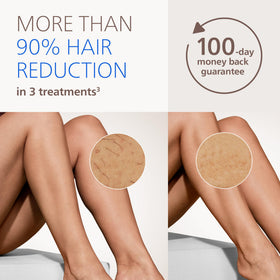 PHILIPS Lumea IPL Hair Removal Device in luxury box