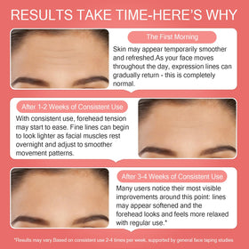 Phlountsy Smile Line Patches in use overnight