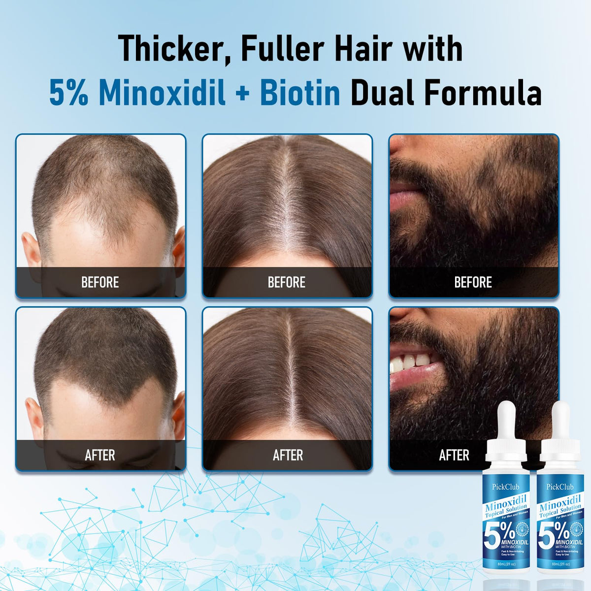 PickClub 5% Minoxidil Hair Regrowth Serum back view