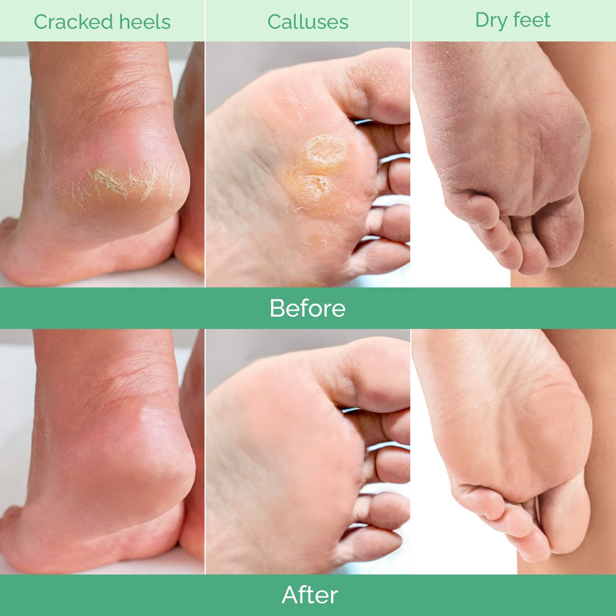 PLANTIFIQUE Foot Peeling Mask Peach application instructions
