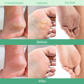 PLANTIFIQUE Foot Peeling Mask Peach application instructions