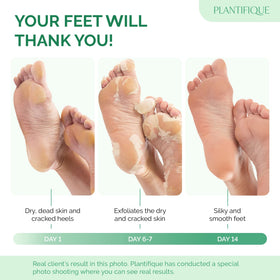 PLANTIFIQUE Foot Peeling Mask Peach packaging