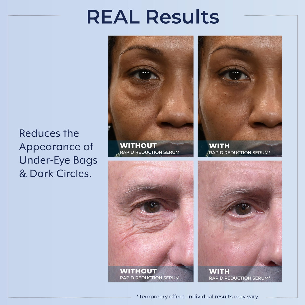 Plexaderm Rapid Reduction Serum before and after results