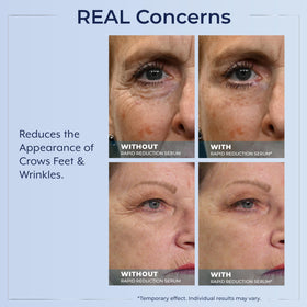 Plexaderm Rapid Reduction Serum in hand