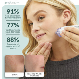 PMD Beauty Personal Microderm Classic with included accessories