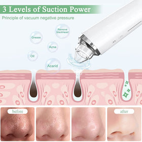 prabensei Blackhead Remover packaging and user manual