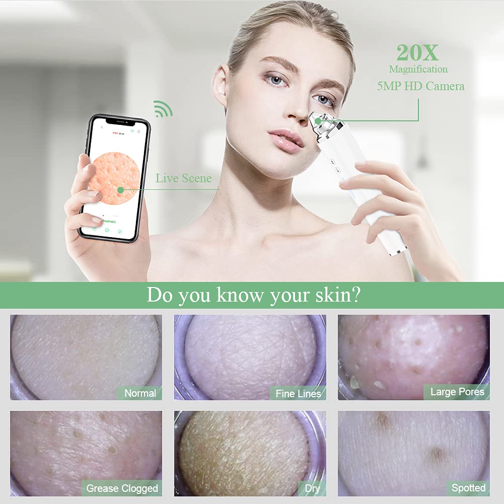 prabensei Blackhead Remover showing 20X magnification display