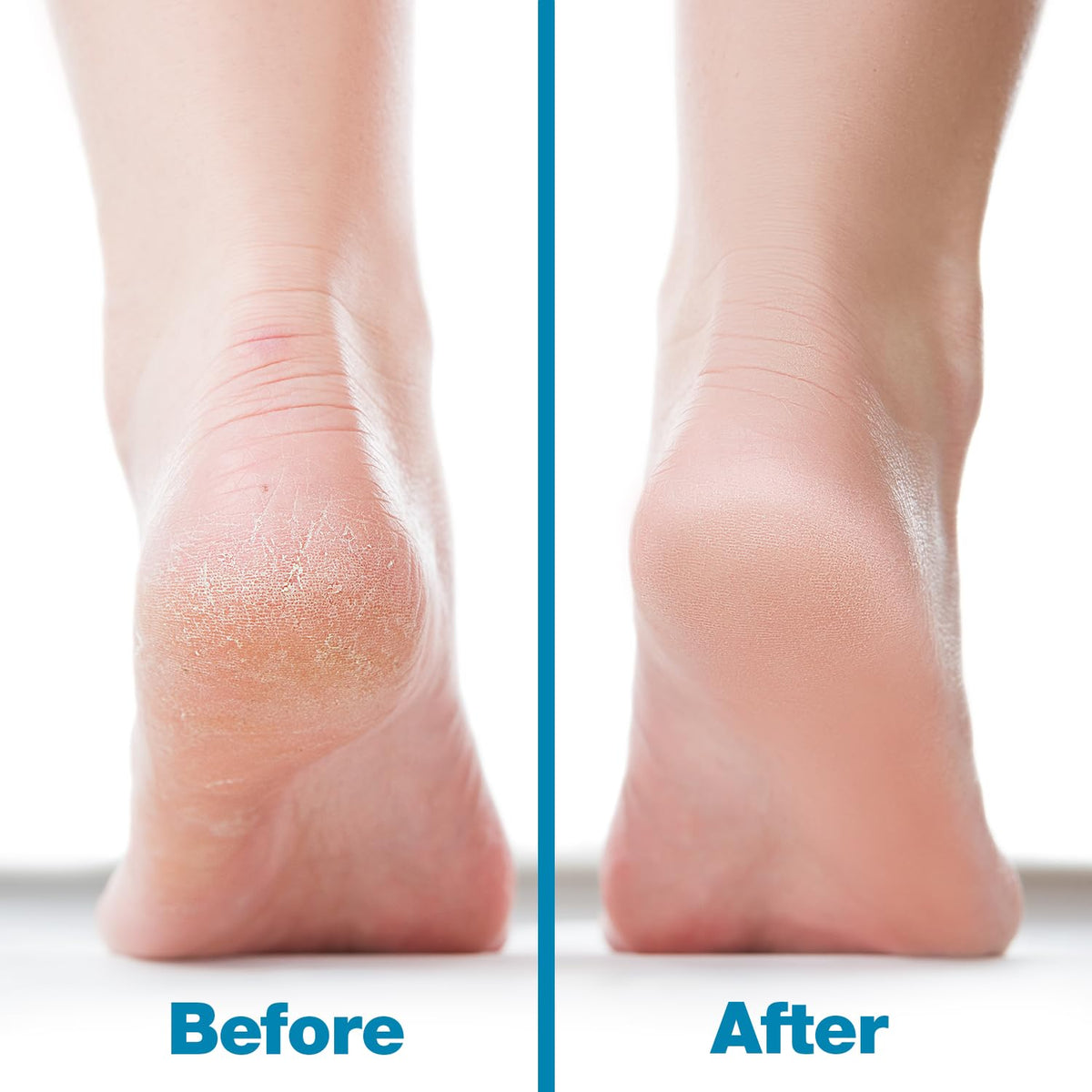 Probelle foot file in hand for easy use