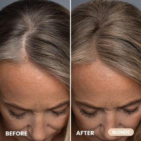 PROMETICS Hairline Powder packaging and applicator