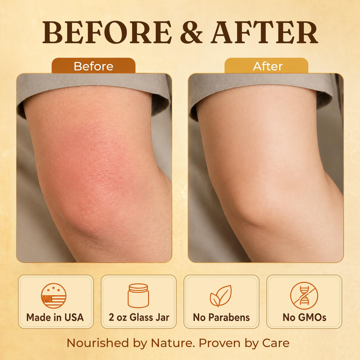ProSeed Manuka Honey Tallow Balm 2 oz lifestyle use