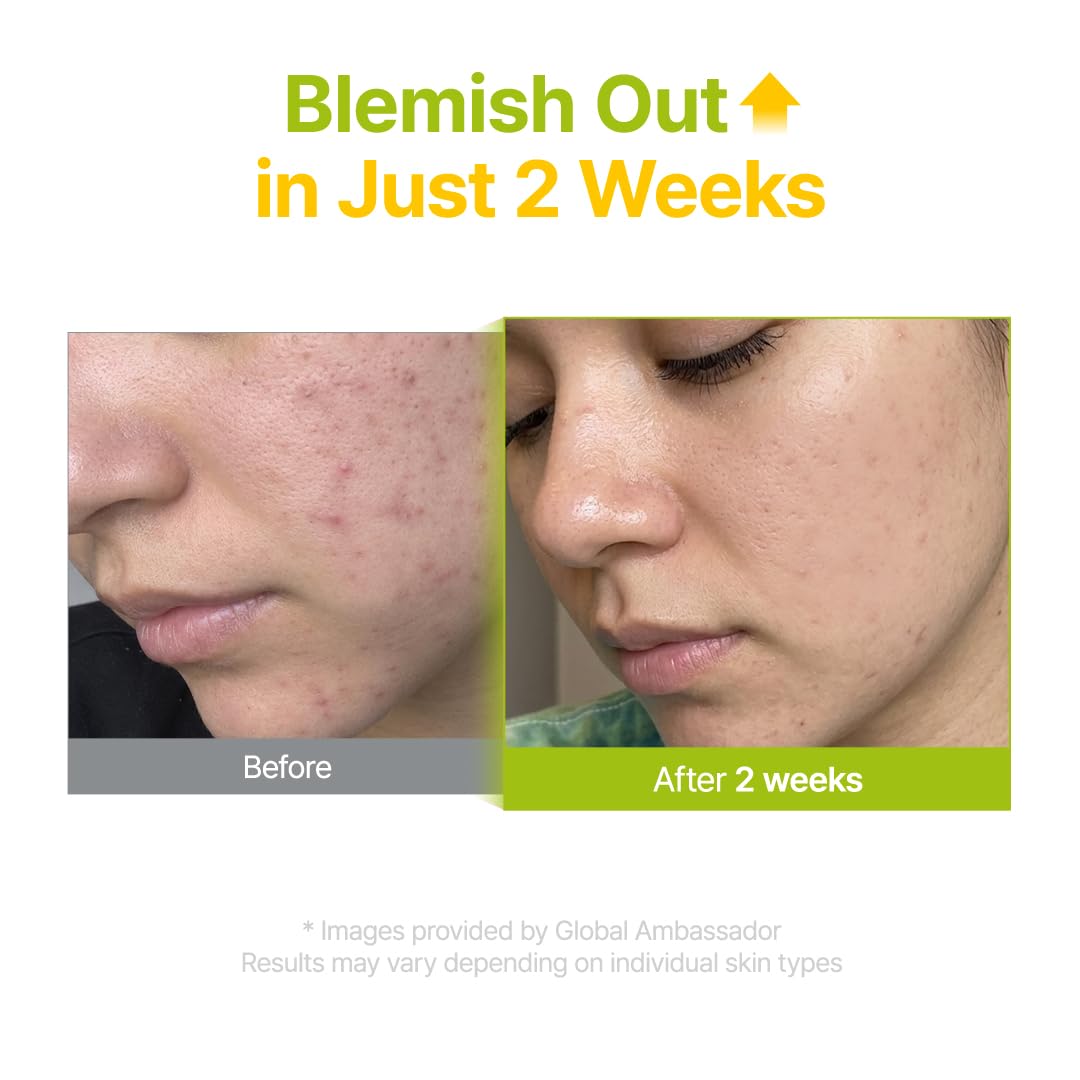 PURITO Azelaic 10% + Kojic Serum application on skin