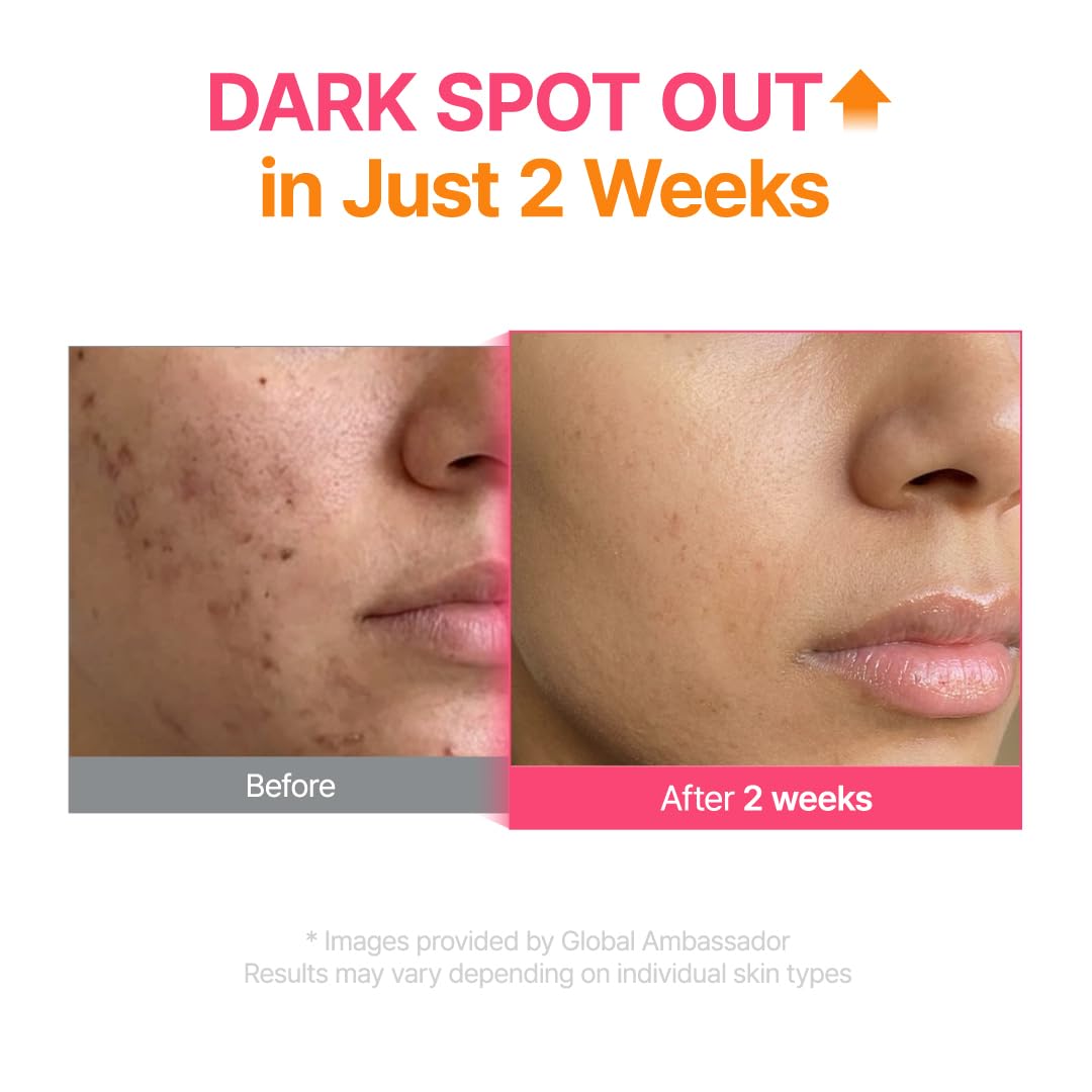 PURITO TXA 6% + Niacinamide Serum lifestyle scene on a bathroom counter