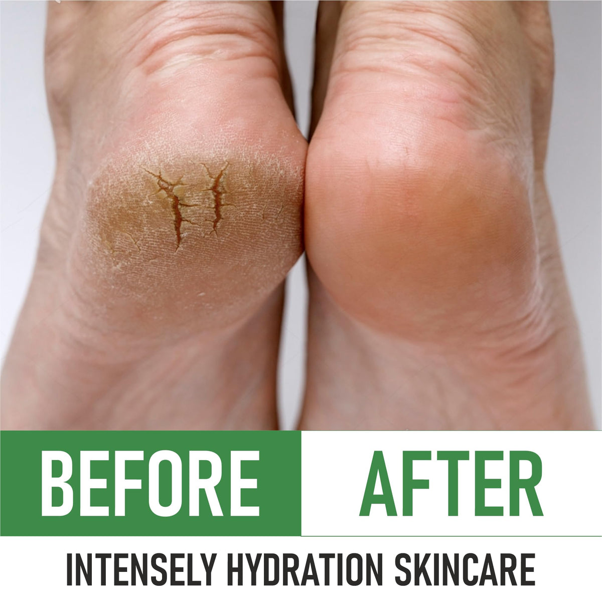 PurOrganica Urea 40% Foot Cream with natural ingredients