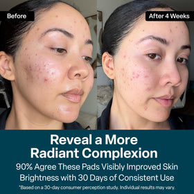 QRxLabs Glycolic Acid Pads 20% jar with pads inside