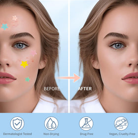 QUSTERE Pimple Patches in pink and yellow