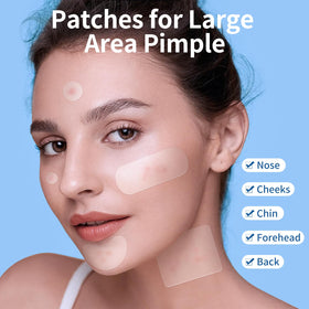 QUSTERE pimple patches in use during a skincare routine