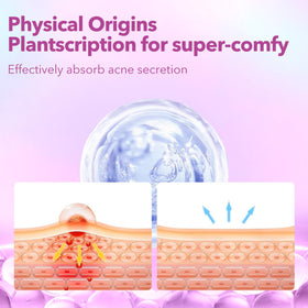 QUSTERE Pimple Patches in various sizes 10mm, 12mm, 14mm