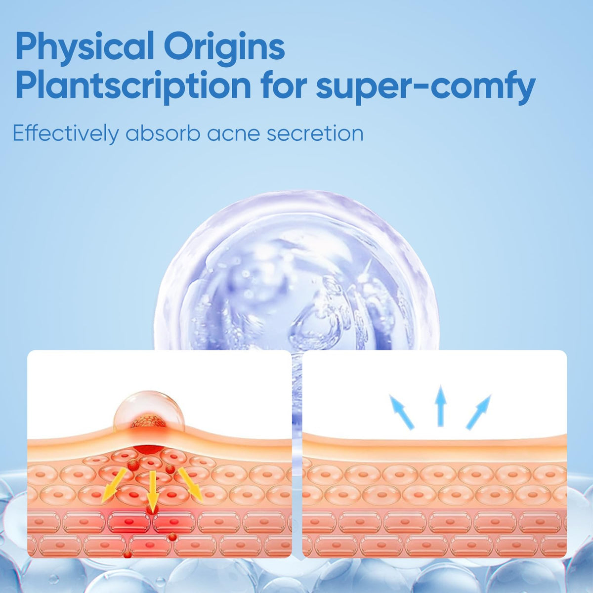 QUSTERE Pimple Patches star design in use