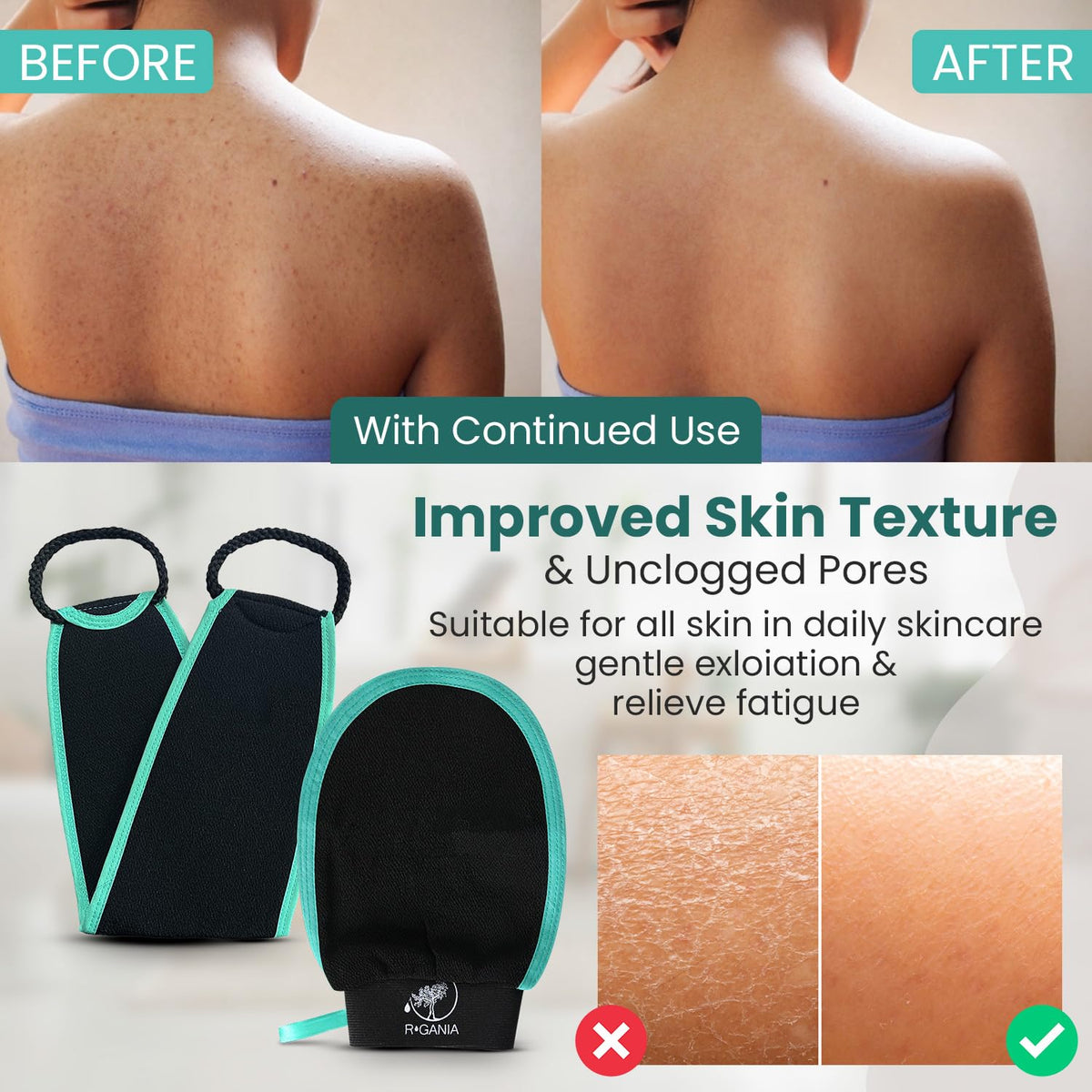 R'GANIA Deep Exfoliating Glove and Back Exfoliator set