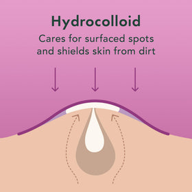 Rael Miracle Overnight Spot Cover Patches in hand