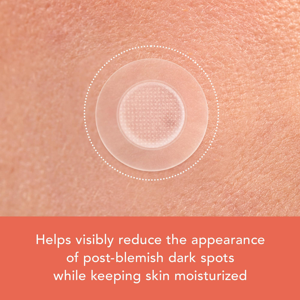 Rael patches applied on skin for blemish care