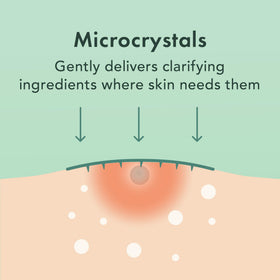 Rael pimple patches showing different sizes