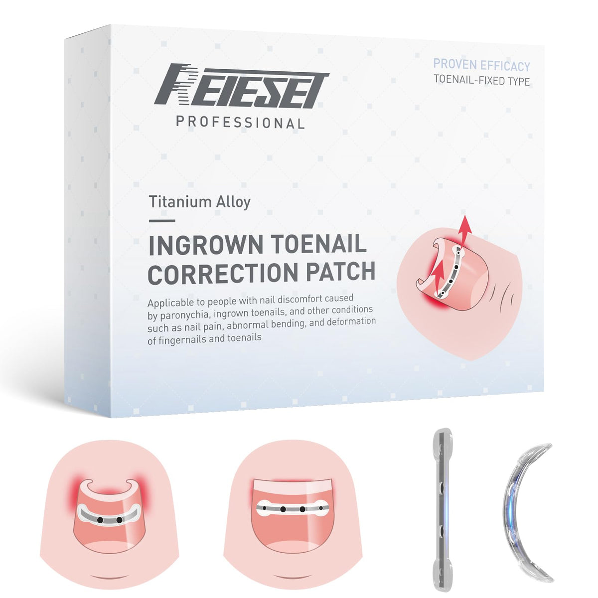 Reieset Ingrown Toenail Removal Kit front view with packaging