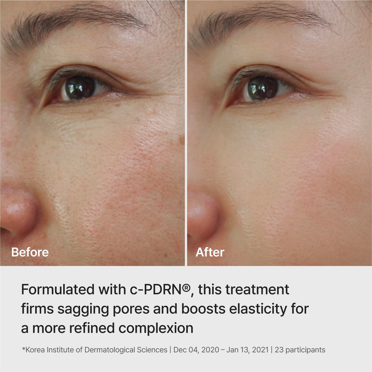 REJURAN Ampoule Infused Lifting Mask ingredients list