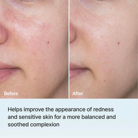 REJURAN Moisture Mask in use with relaxing background