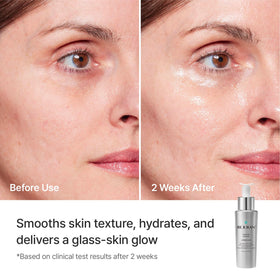 REJURAN Turnover Ampoule 10mL lifestyle shot