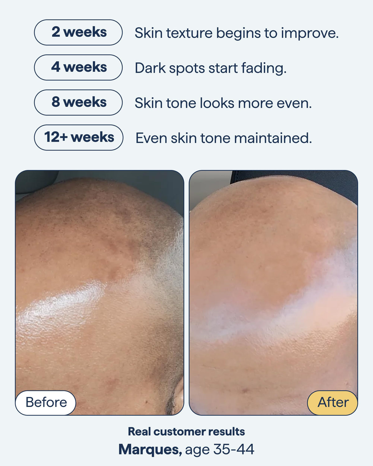 Remedy Science Dark Spot Correcting Serum side view with pump