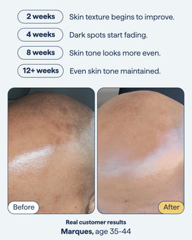 Remedy Science Dark Spot Correcting Serum side view with pump