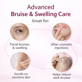 RMCYDS Arnica Bruise Cream application on skin