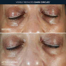 RoC Brightening 5 in 1 Eye Cream ingredients list